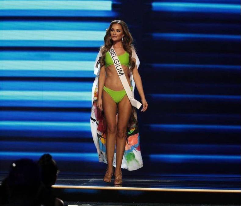 Miss Bélgica en estado crítico tras aparatoso accidente