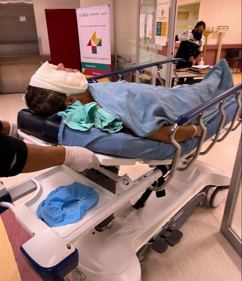 El presentador compartió en su cuenta de Instagram las imágenes de como luce su rostro. 