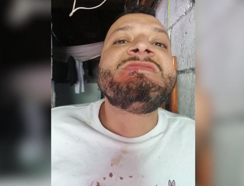 Dan paliza a Gilbert Reyes, ‘Pescado’ Bonilla y Chepito Handal en la cárcel