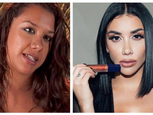 Karime Pindter, actual participante de “La Casa de los Famosos México” es toda una sensación en redes sociales, pues a 10 años de haber iniciado su carrera en los realitys shows mexicanos, luce mejor que nunca y como ha sido costumbre, no se ha callado respeto a las operaciones que se ha hecho en su vida.