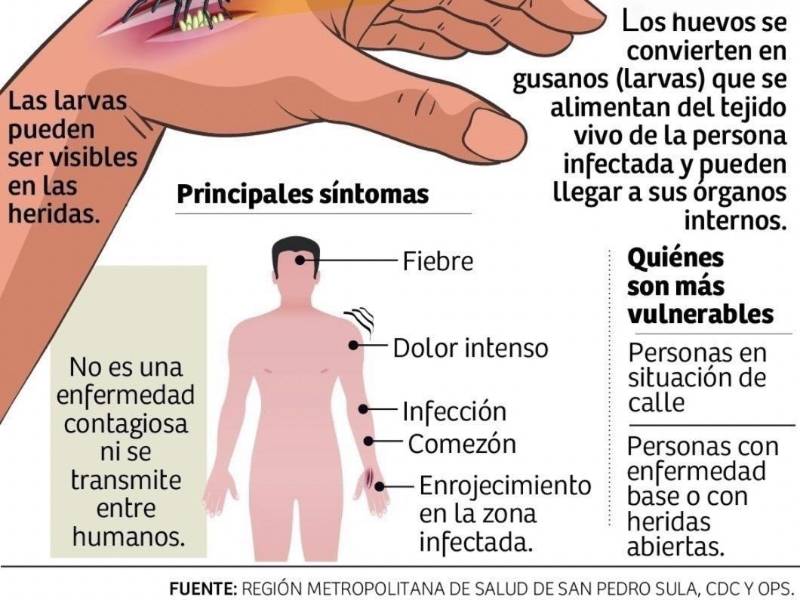 Confirman tres casos de miasis por gusano barrenador en humanos en San Pedro Sula
