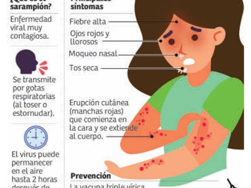 Más de 15,000 vacunas contra el sarampión disponibles en Cortés