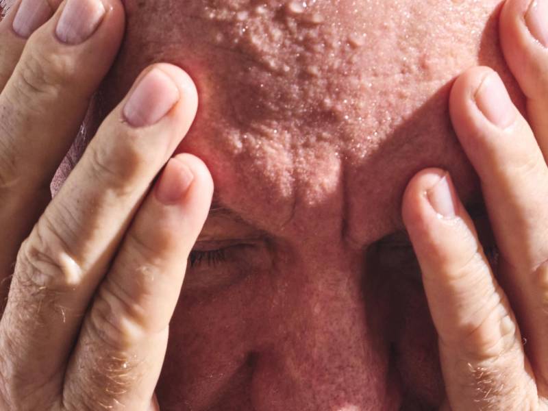 Los bebés y las personas mayores son particularmente vulnerables al calor extremo.