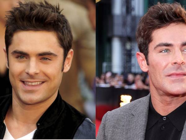 Han pasado 11 años desde que el actor Zac Efron sufrió un accidente que hizo que le reconstruyeran la mandíbula, pero es hasta ahora cuando los fans parecen notarlo tras el estreno de su nueva película “A Family Affair”, de Netflix. Luego de ver esta comedia romántica, en redes sociales no han parado de criticarlo por su aspecto, asumiendo que el exceso de botox arruinó la belleza que lo caracterizaba en su época donde protagonizó la serie “High School Musical”.