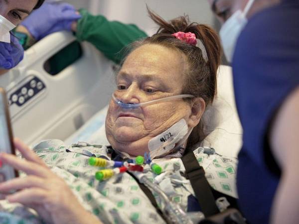 La mujer se convirtió en la segunda persona en recibir un trasplante de un riñón de cerdo.