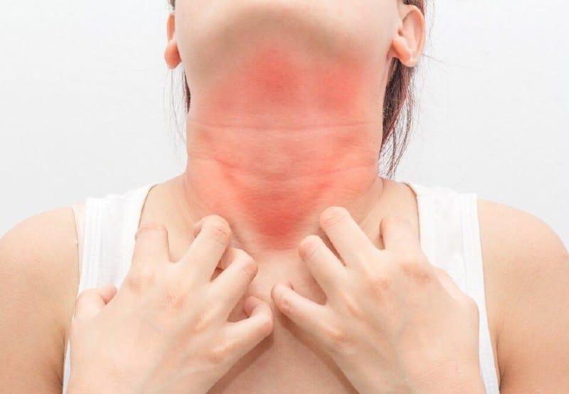 En algunos casos, puede haber una reacción retardada, o la anafilaxis puede producirse sin la presencia de un desencadenante obvio.