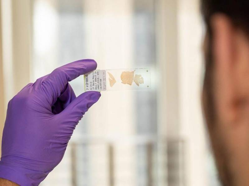 Un miembro del laboratorio de la Universidad Northwestern examina un portaobjetos de vidrio que contiene una lámina finísima del cerebro de un 'superanciano'.