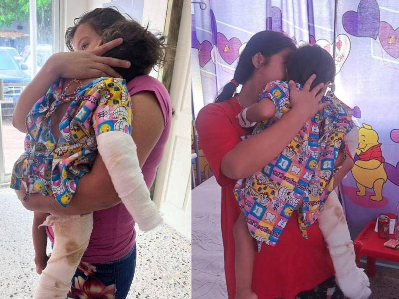 La Dirección Policial de Investigación (DPI) activó este lunes un operativo para dar con el paradero de un hombre acusado de agredir brutalmente a su hijastro en el municipio de Concepción del Norte, departamento de Santa Bárbara.