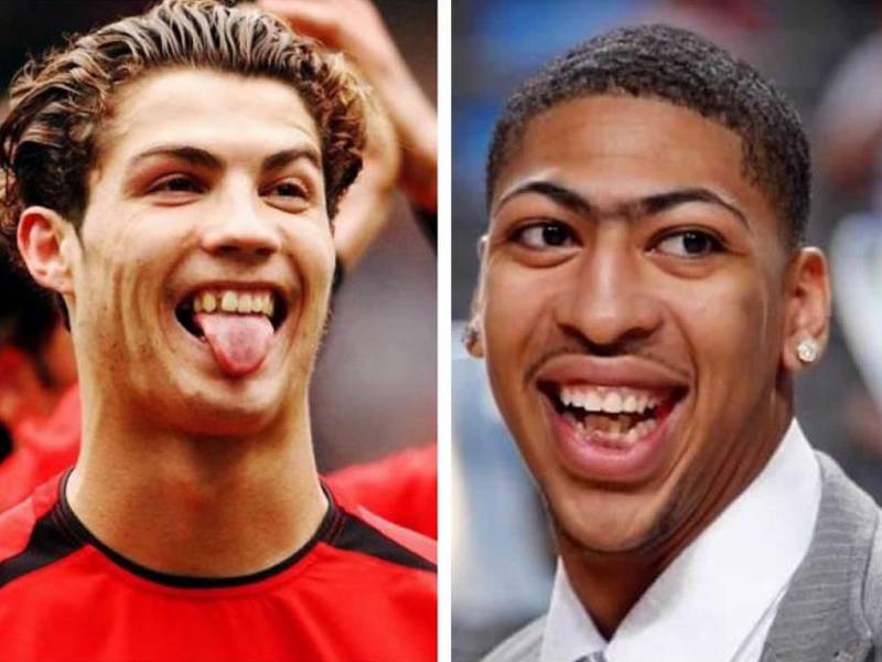 Muchos deportistas han decidido invertir en su aspecto y visitar al dentista para poder brillar dentro y fuera de la cancha. Estos son algunos jugadores que se sometieron a tratamientos dentales para mejorar su aspecto.