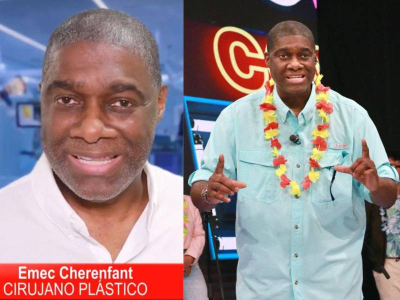 El reconocido cirujano plástico radicado en Honduras, Emec Cherenfant, reveló recientemente que son bastantes los hombres hondureños que llegan a su clínica en busca de modificar sus partes íntimas.