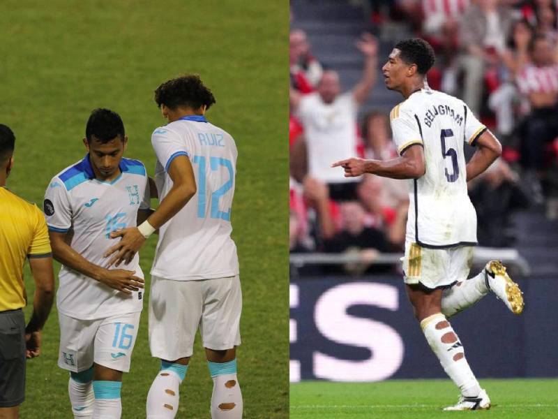 David Ruiz jugó así: La razón por la que los futbolistas usan medias rotas