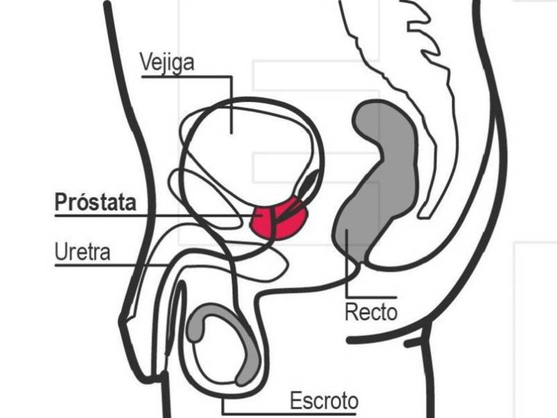 Los diagnósticos de cáncer de próstata aumentaron un 3 % anual entre 2014 y 2021 en EE.UU., según el informe anual de la ACS.