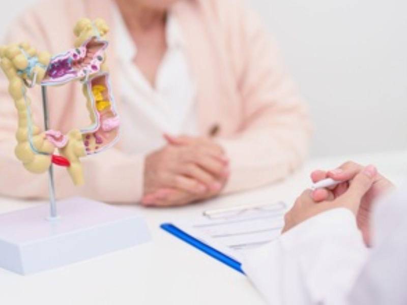 Según la Asociación Americana del Cáncer, cuando el cáncer de colon se detecta antes de que se haya propagado, alrededor de nueve de cada diez pacientes siguen vivos cinco años después del diagnóstico.