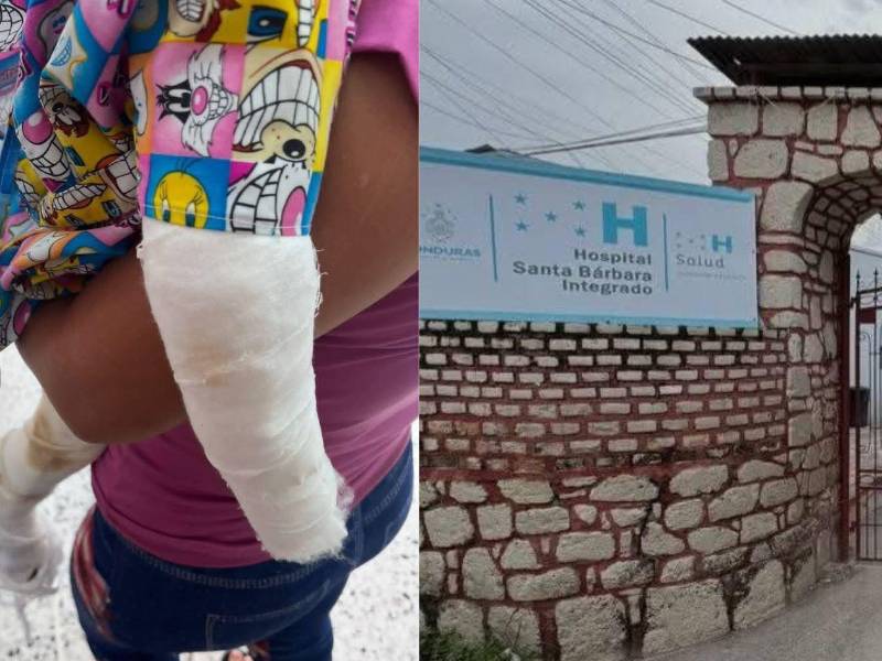 Un niño de apenas dos años se encuentra grave tras ser presuntamente agredido por su padrastro en el municipio de Concepción del Norte, Santa Bárbara. Su madre rompió el silencio sobre lo sucedido; esto fue lo que dijo.
