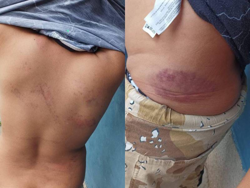 Capturan a expolicía en SPS acusado de golpear a su hijo de 10 años