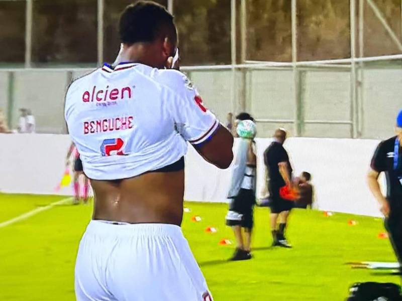 Jorge Benguché se marchó lesionado y hay alarma en Olimpia.