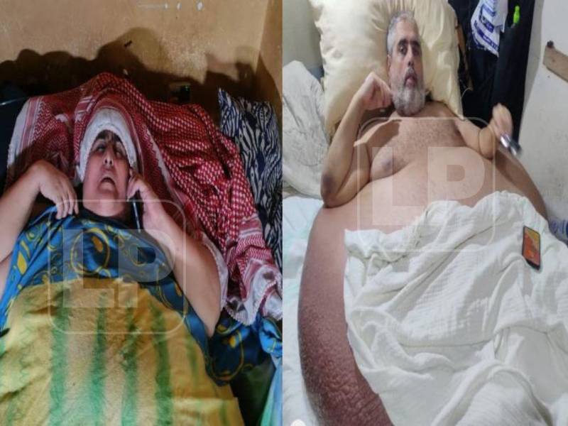 Basima y Nasser Hilsaca se hicieron conocidos cuando Nasser tuvo que ser trasladado en grúa desde su apartamento debido a la obesidad que padece. Los hermanos viven juntos en una vivienda de La Ceiba y permanecen postrados en cama, afectados no solo por la obesidad que les dificulta moverse, sino también por otras enfermedades.