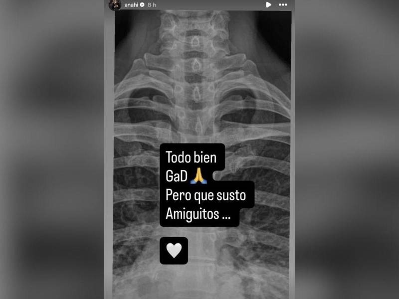 Radiografía publicada por Anahí.