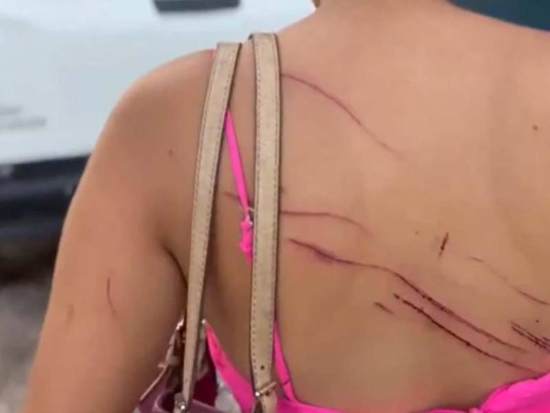 Imagen de la víctima agredida por la pareja.