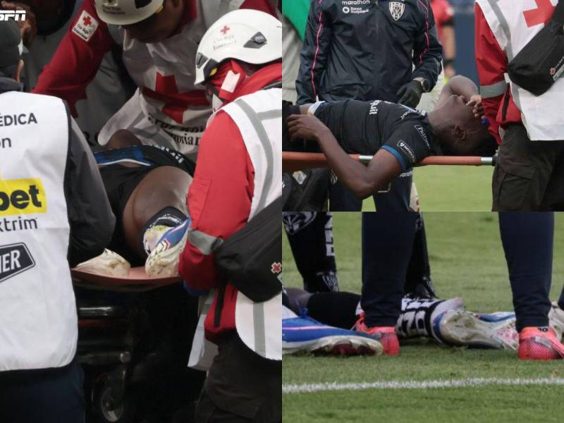 Escalofriante lesión de Jean Pierre Arroyo: su club y agresor reaccionan