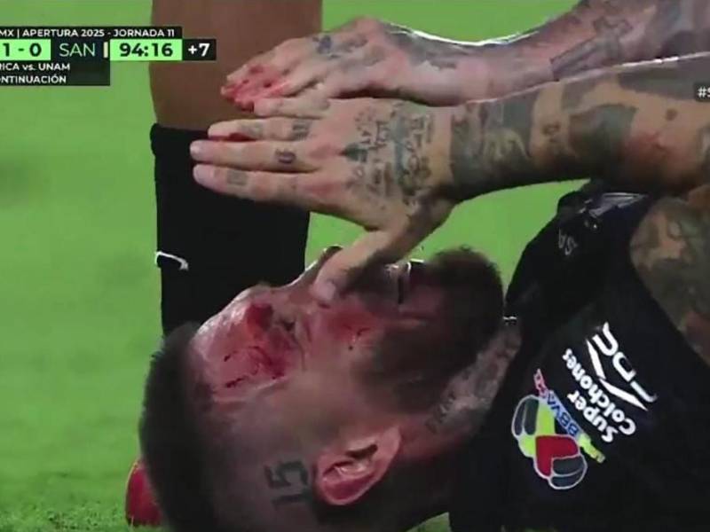 Así le quedó el rostro a Sergio Ramos tras brutal patada del Choco Lozano.