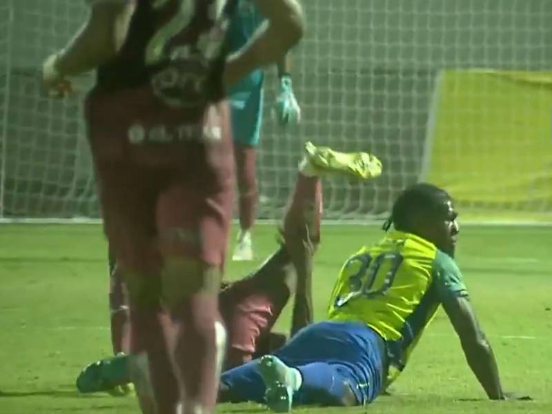 El tobillo izquierdo de Romario Da Silva quedó doblado tras la grave fractura.