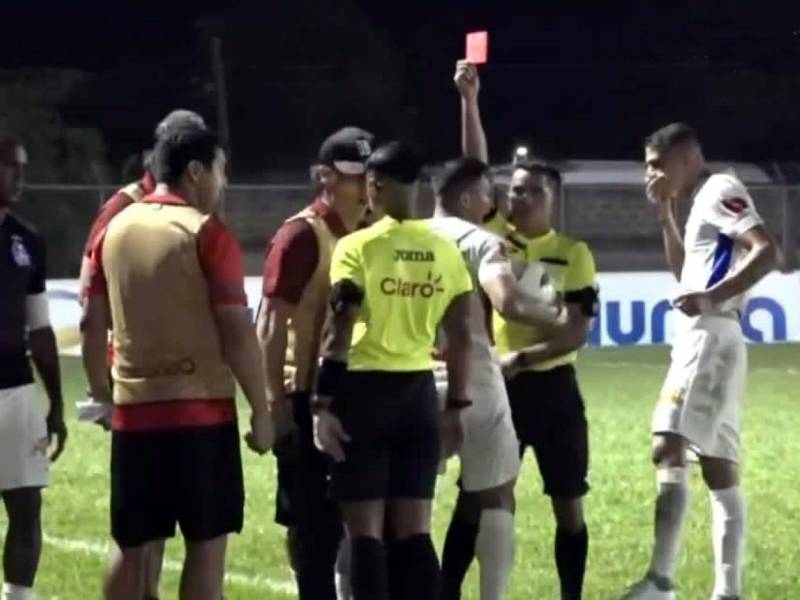 Pedro Troglio fue expulsado en el partido Real Sociedad-Olimpia.