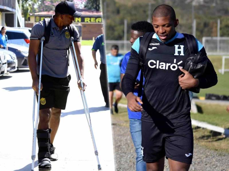 Luis ‘Buba‘ López busca la manera de recuperarse lo más pronto posible para poder estar presente en el partido de Honduras ante Costa Rica.