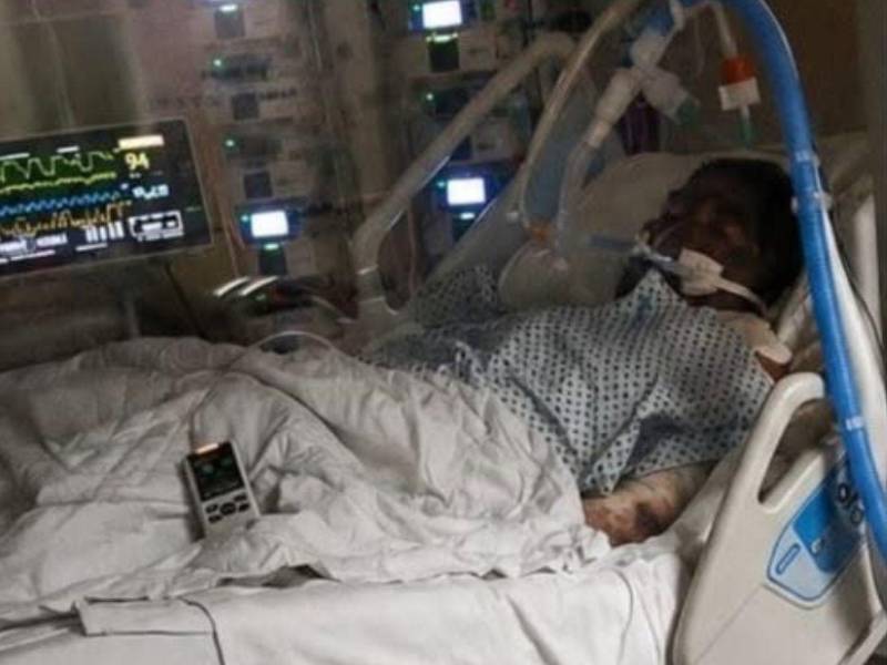 De acuerdo con sus familiares Juan Antonio Rivera Suazo resultó con quemaduras de segundo y tercer grado.