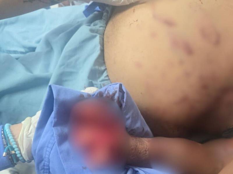 El hombre resultó con heridas graves en su mano izquierda y tórax.