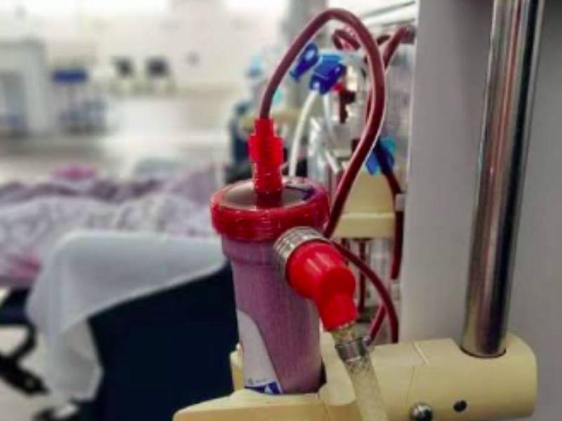 La hemofilia es un trastorno hereditario que afecta la capacidad de la sangre para coagular debido a la ausencia o disminución de determinadas proteínas.