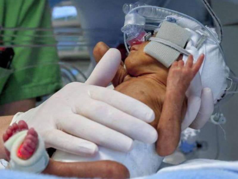 Doce recién nacidos fallecieron en un hospital de Ecuador.