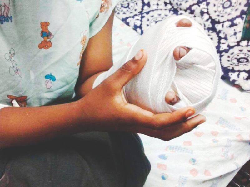 Un niño con quemaduras es atendido en un hospital de Honduras en una fotografía de archivo.