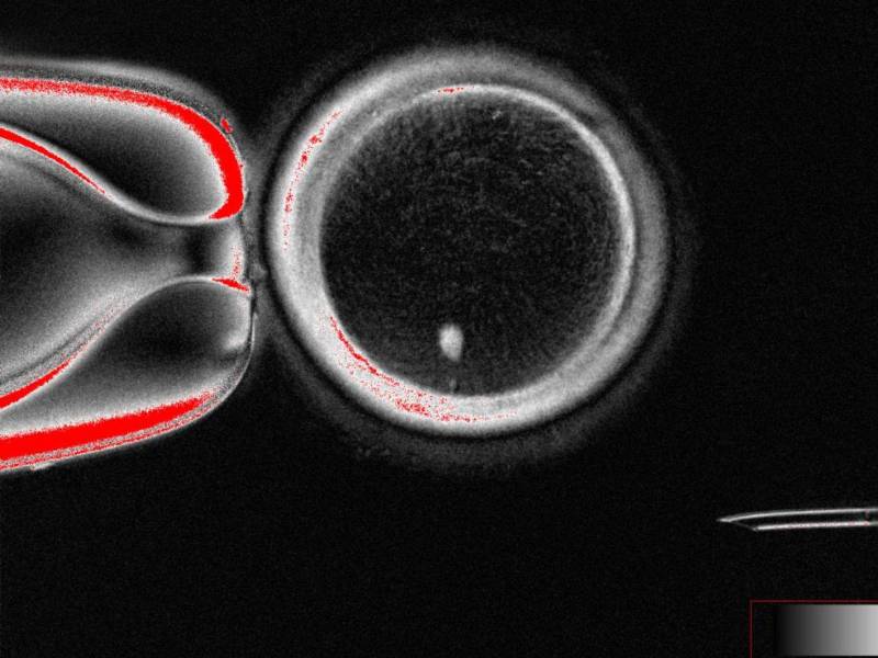 Ovocito humano con transferencia nuclear de células somáticas con huso visible (punto brillante en el interior) antes de la fecundación.