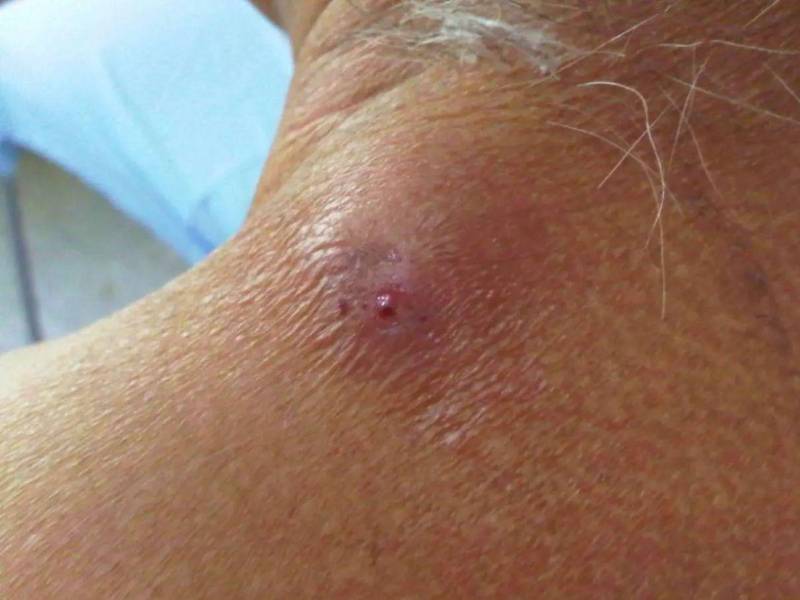 Detectaron tres nuevos casos de gusano barrenador en Honduras durante 2026.