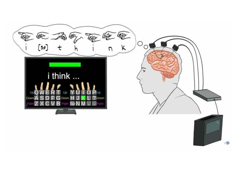 El estudio, liderado por investigadores del Instituto de Neurociencia del Mass General Brigham y la Universidad de Brown describe una neuroprótesis de escritura con interfaz cerebro-computadora (iBCI, por sus siglas en inglés) que se encuentra en fase de investigación y que puede restaurar la comunicación con rapidez y precisión. Fotografía facilitada por Mass General Brigham