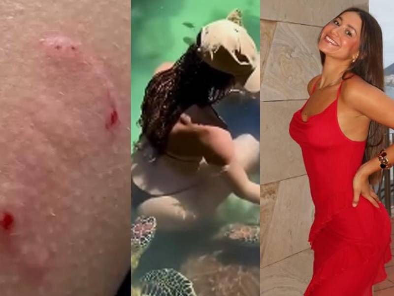<b>Cynthia Benítez Fernández vivió un inesperado momento durante sus vacaciones en Zanzíbar, cuando una tortuga marina la mordió mientras estaba en el agua.</b>