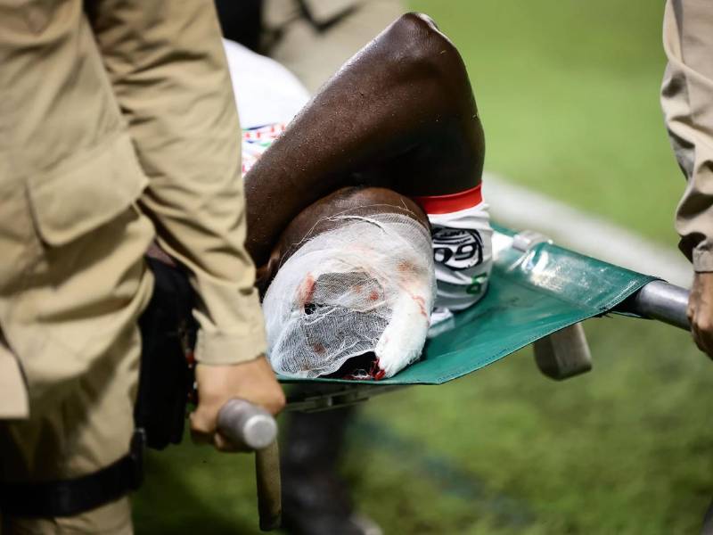 El jugador Nibiri Martínez de la Real Sociedad sufrió un duro golpe en la cabeza y salió con sangre y un vendaje.