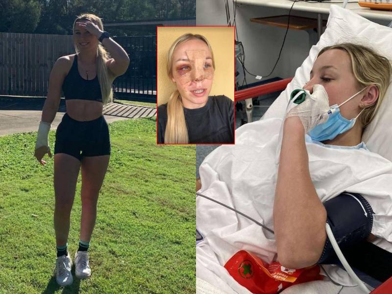 Joven sufre terribles heridas en el rostro tras fuerte accidente en motocross