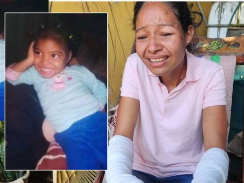 María Montoya, aún con sus manos vendadas y entre el llanto, intenta asimilar que su hija Siloé ya no le pedirá más que la chinee.