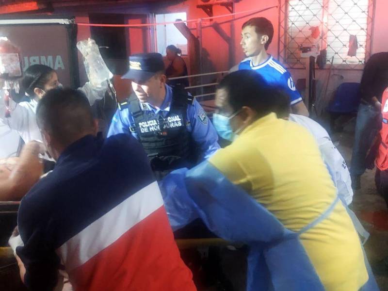En el Hospital Mario Catarino Rivas de San Pedro Sula permanecen 11 personas víctimas del fatal accidente.