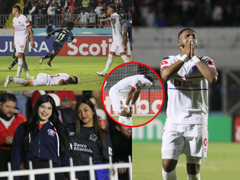 Las imágenes que dejó la derrota del Olimpia 1-2 contra el Club América de México en el partido de ida de la ronda previa de la Concacaf Champions Cup.