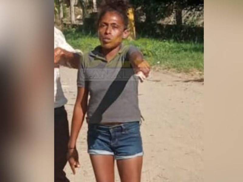 La mujer fallecida en vida era conocida como La Loba y andaba en condición de indigencia.