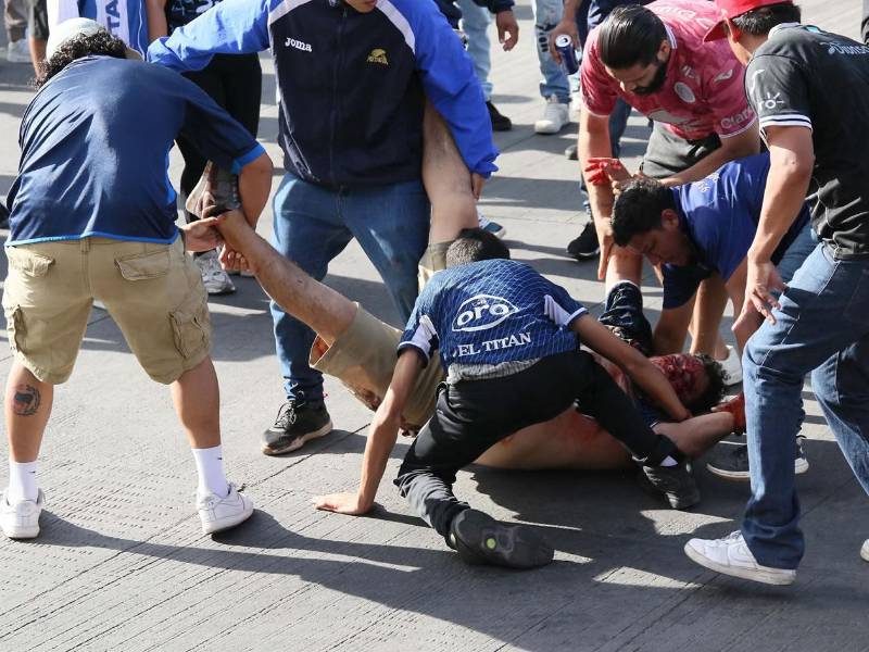 Este aficionado resulto con graves heridas de bala durante el enfrentamientos de barras afuera del estadio Nacional Chelato Uclés.