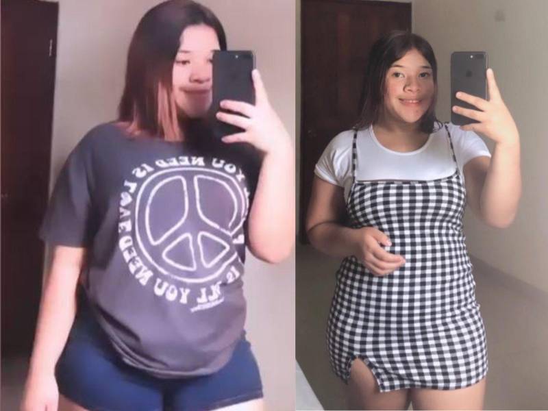 Lesli Hernández, de 18 años, murió en un trágico accidente vehicular registrado el martes 12 de mayo en la carretera que conecta Olanchito con Jocón, en el departamento de Yoro.