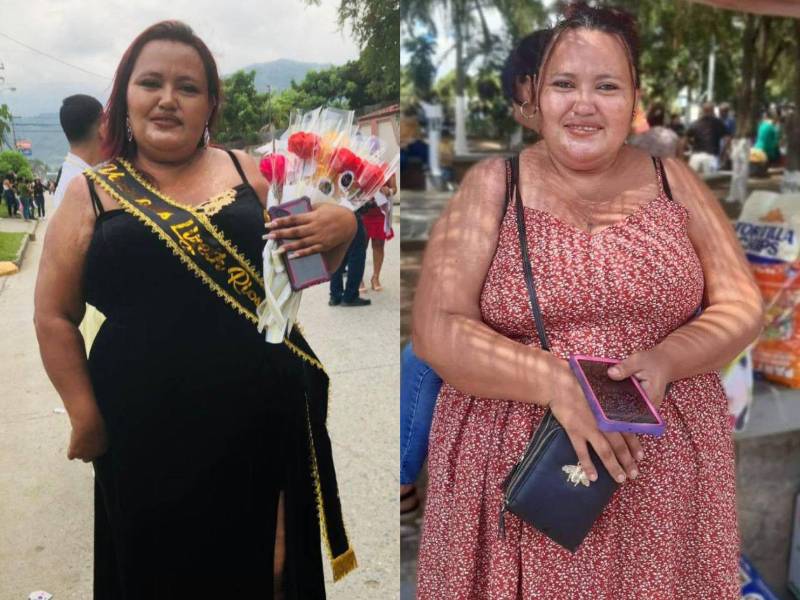 Muere Lizeth Ríos, reconocida emprendedora de El Progreso