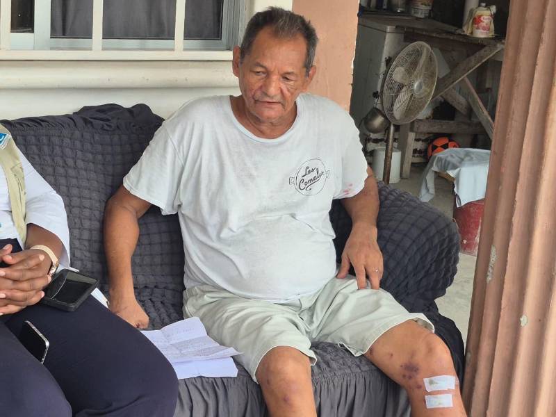 El ciudadano César Chávez resultó gravemente herido tras ser atacado por los perros pitbull, logrando salvar su vida en un acto de supervivencia y ser auxiliado por vecinos de las residencial Vistas de Satuyé donde reside.