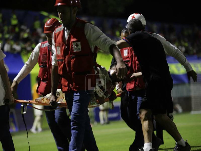 Chirinos salió lesionado en el duelo entre el Olimpia y Olancho en el Juan Ramón Brevé.