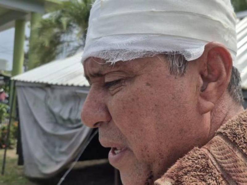 Nelson Andino denunció formalmente a su hijo por maltrato familiar, luego de agredirlo y ser atendido en el hospital Atlántida.