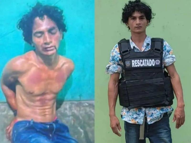 José Enrique Redondo Amaya manchó su cuerpo con salsa de tomate para que parecieran golpes. Envió las fotos a su hermana en Estados Unidos.